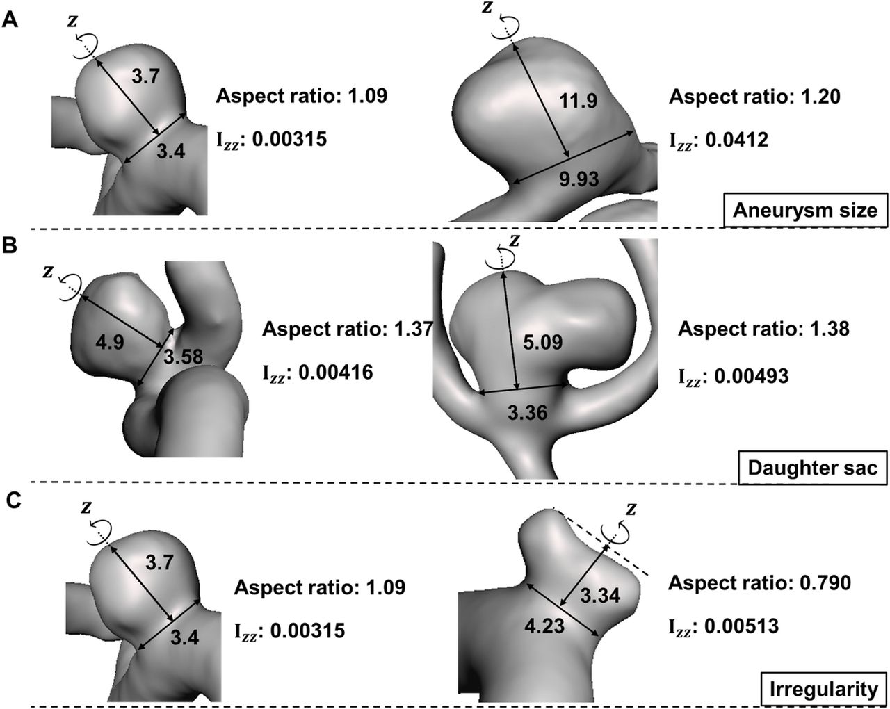New morphological parameter for intracranial aneurysms and rupture risk ...